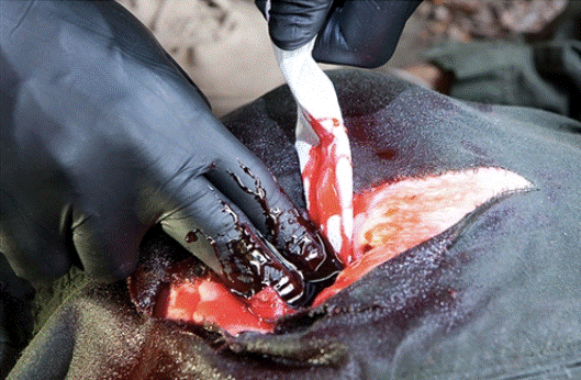 Control de Hemorragias